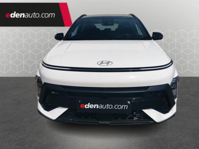 Hyundai Kona image 3