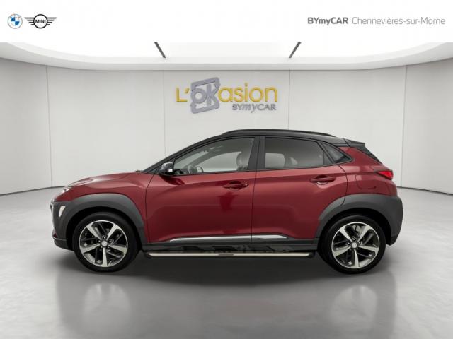 Hyundai Kona image 4